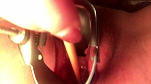 cervix insertion stretches deep