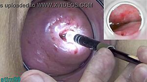 Intense Cervix Exploration!