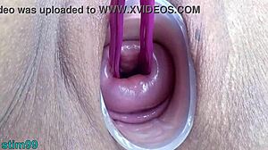 Prolapsed Cervix Lesbians Extreme Insertion